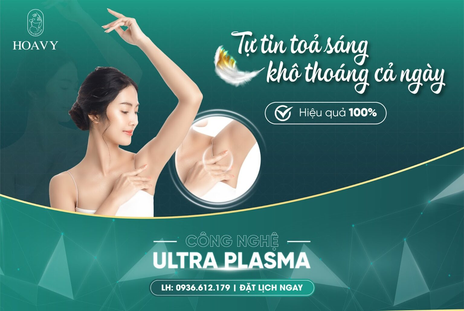 Trị hôi nách bằng Ultra Plasma là giải pháp thay thế hoàn hảo cho phẫu thuật cắt tuyến mồ hôi 